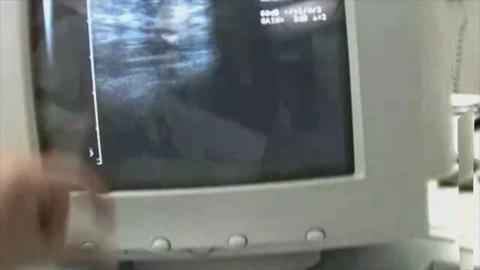 2846